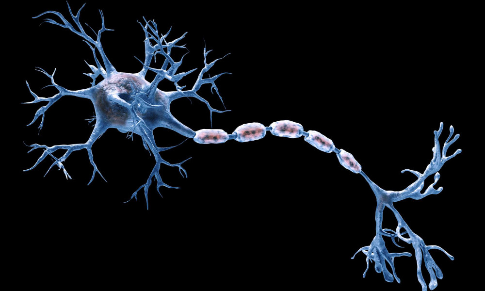 Wird die isolierende Myelinschicht einer Nervenfaser fälschlicherweise durch das Immunsystem beschädigt, können Nervenzellen ihre Signale nicht weiterleiten.